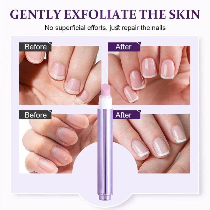 Ceramic Pocket Cuticle Remover - Aninail